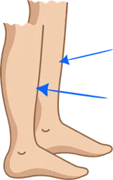 shins.webp